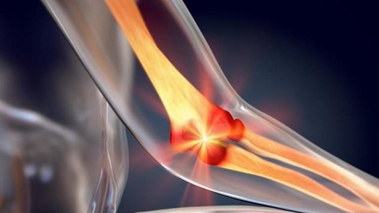 Futbolunuz eksikse, bu hastalıkları alabilirsiniz! Kalsiyum eksikliğinde görülen hastalıklar nelerdir? Hangi hastalıklar kalsiyum eksikliğine neden olur?